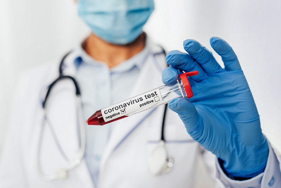 close up doctor holding coronavirus test