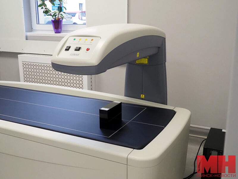 2025 03 14 mediczina 6 bolnicza kabinet osteodensitometrii mozolevskij 03 kopiya