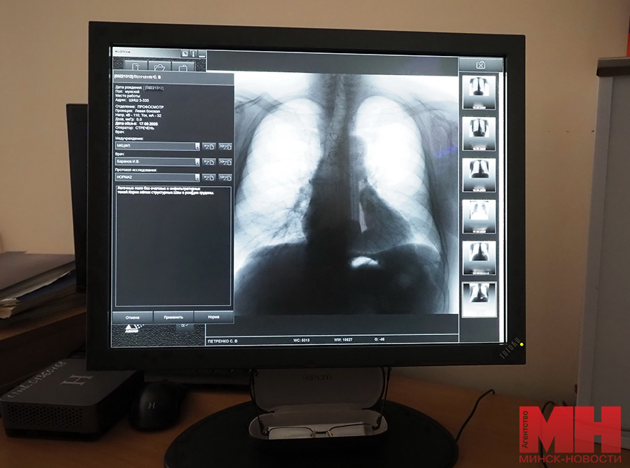 2025 09 18 mediczina czentr ftiziopulmonologii strigelskij mozolevskij 11 kopiya